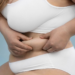Transforming Your Belly Button: A Comprehensive Guide to Post-Tummy Tuck Care